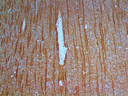 IHC of Myelin Basic Protein on an FFPE Brain Tissue